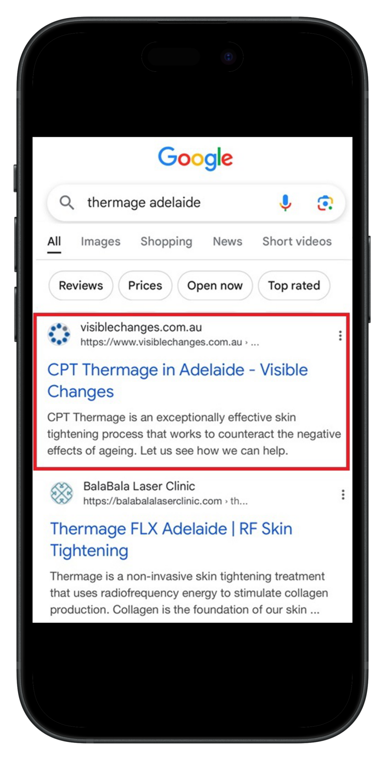 Client's ranking at Google displayed on an iphone when 'Thermage Adelaide' is searched for at Google.